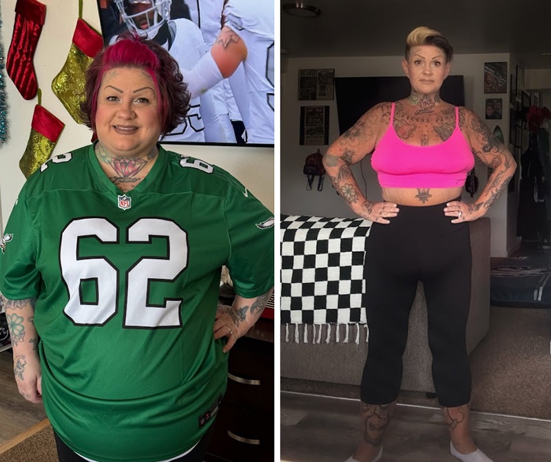 Before and After Weight Loss